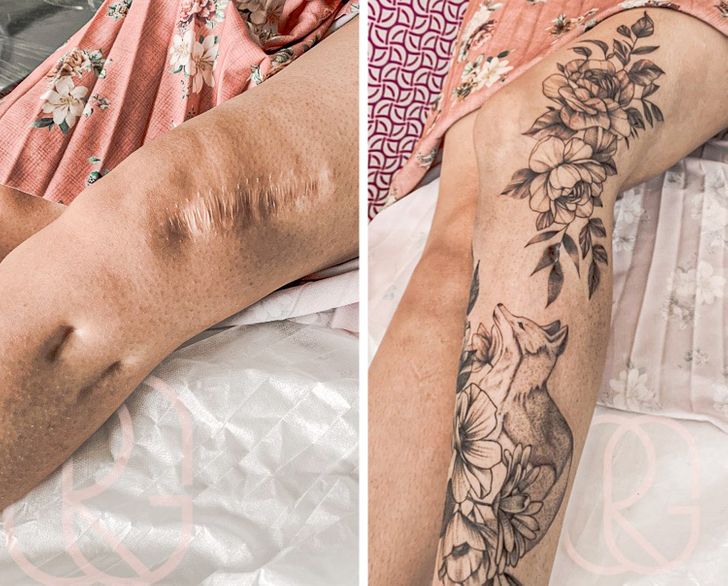 convirtiendo cicatrices en hermosos tatuajes