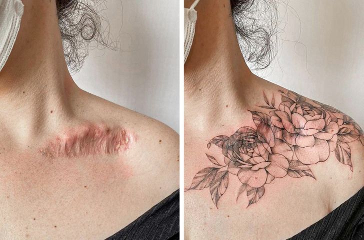 convirtiendo cicatrices en hermosos tatuajes