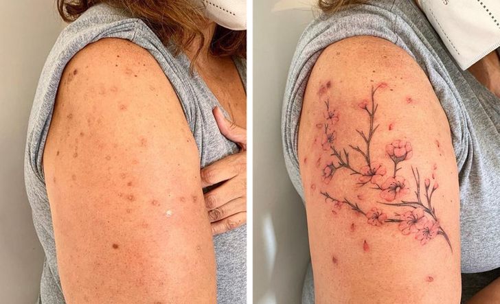 convirtiendo cicatrices en hermosos tatuajes