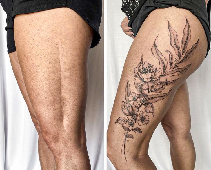convirtiendo cicatrices en hermosos tatuajes