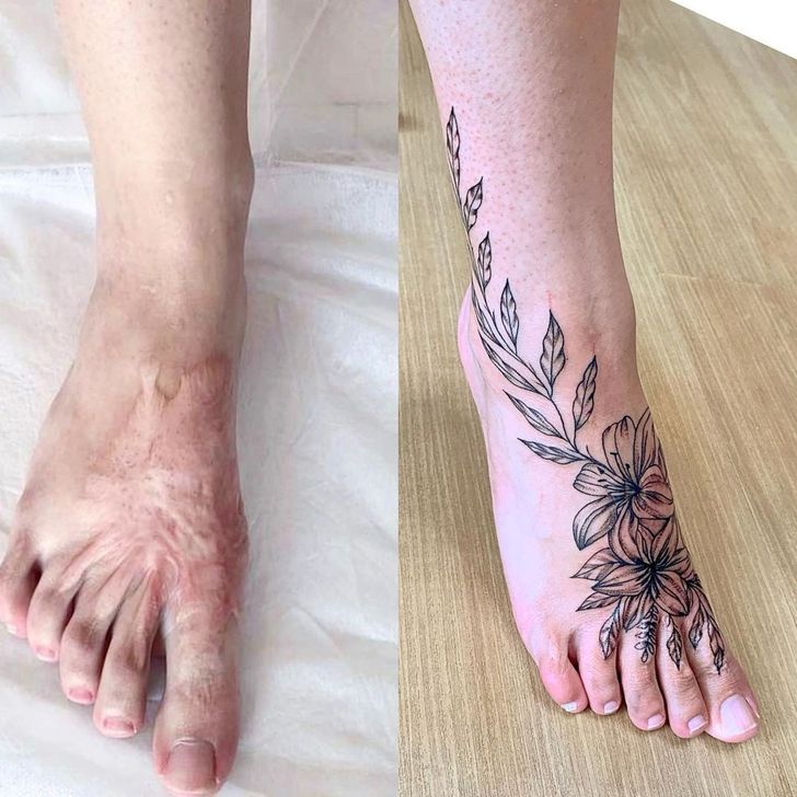 convirtiendo cicatrices en hermosos tatuajes