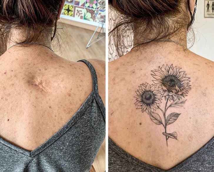 convirtiendo cicatrices en hermosos tatuajes