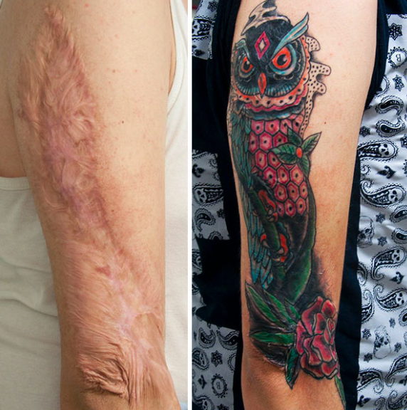 convirtiendo cicatrices en hermosos tatuajes