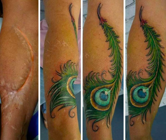 convirtiendo cicatrices en hermosos tatuajes