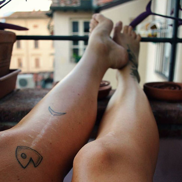 convirtiendo cicatrices en hermosos tatuajes