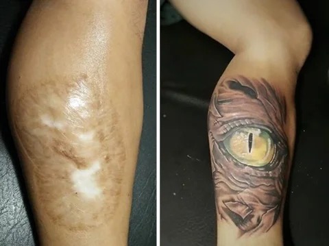convirtiendo cicatrices en hermosos tatuajes