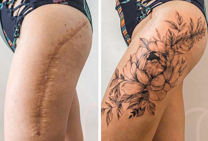convirtiendo cicatrices en hermosos tatuajes