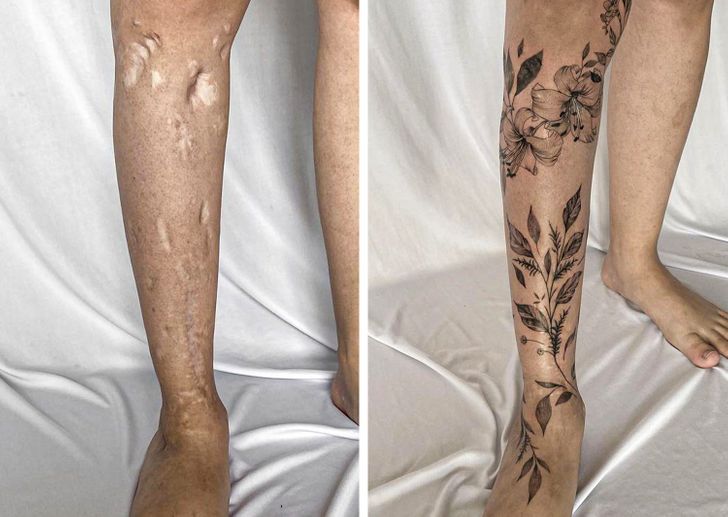 convirtiendo cicatrices en hermosos tatuajes
