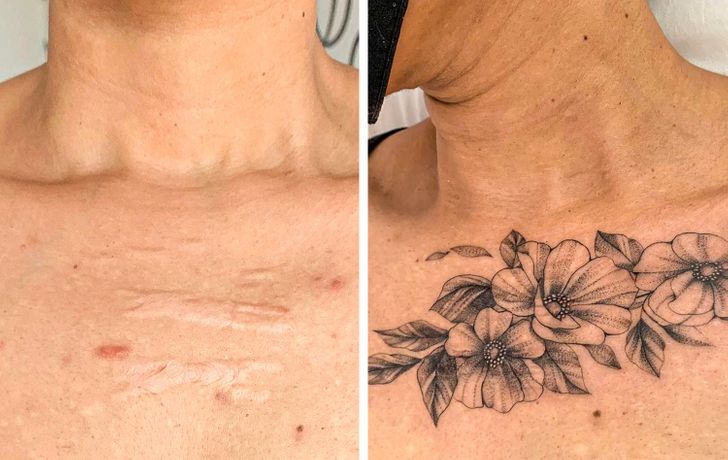 convirtiendo cicatrices en hermosos tatuajes