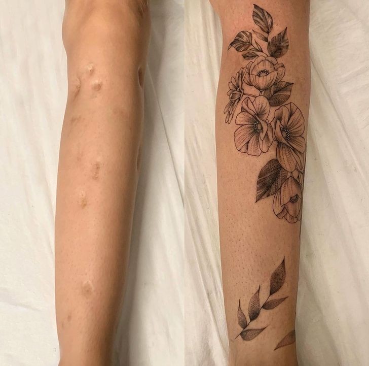 convirtiendo cicatrices en hermosos tatuajes