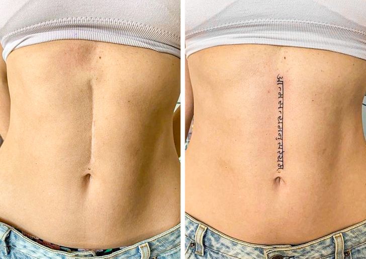 convirtiendo cicatrices en hermosos tatuajes