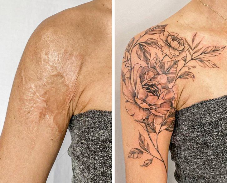convirtiendo cicatrices en hermosos tatuajes