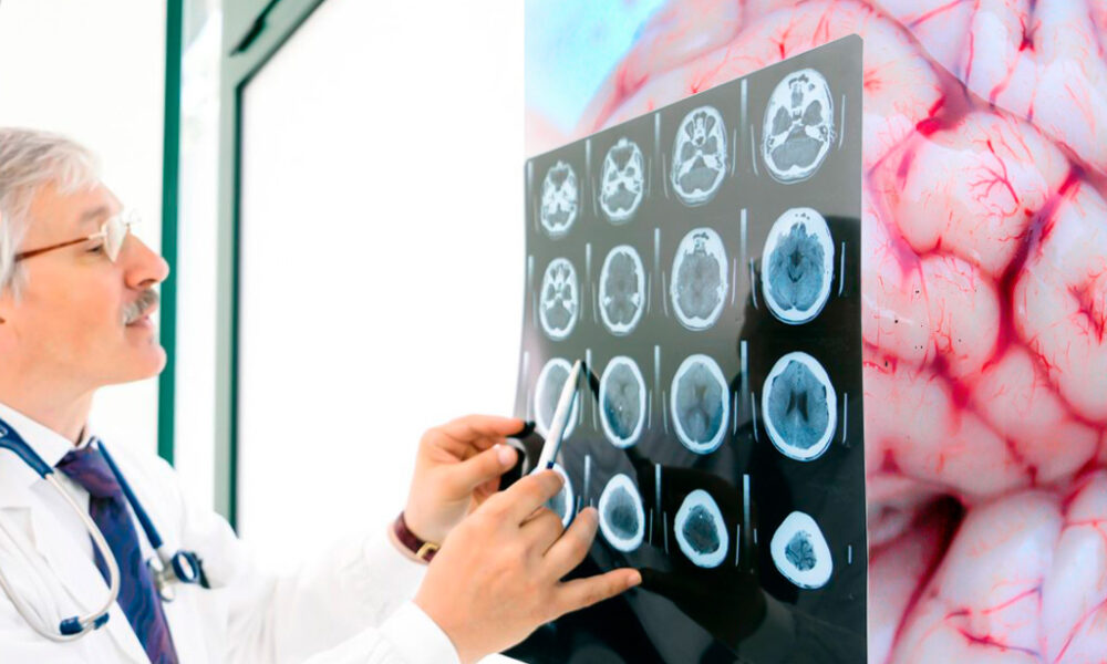 Conoce cómo se forma el cerebro humano y cuales son sus misterios