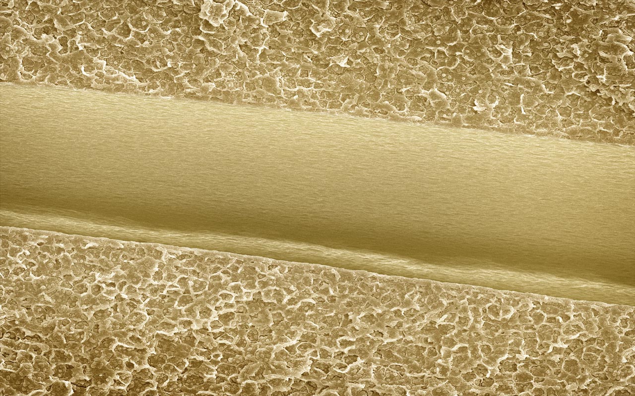 Almendra bajo el microscopio