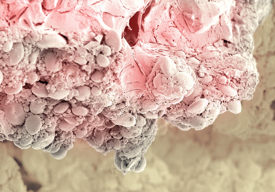Pastel debajo de un microscopio