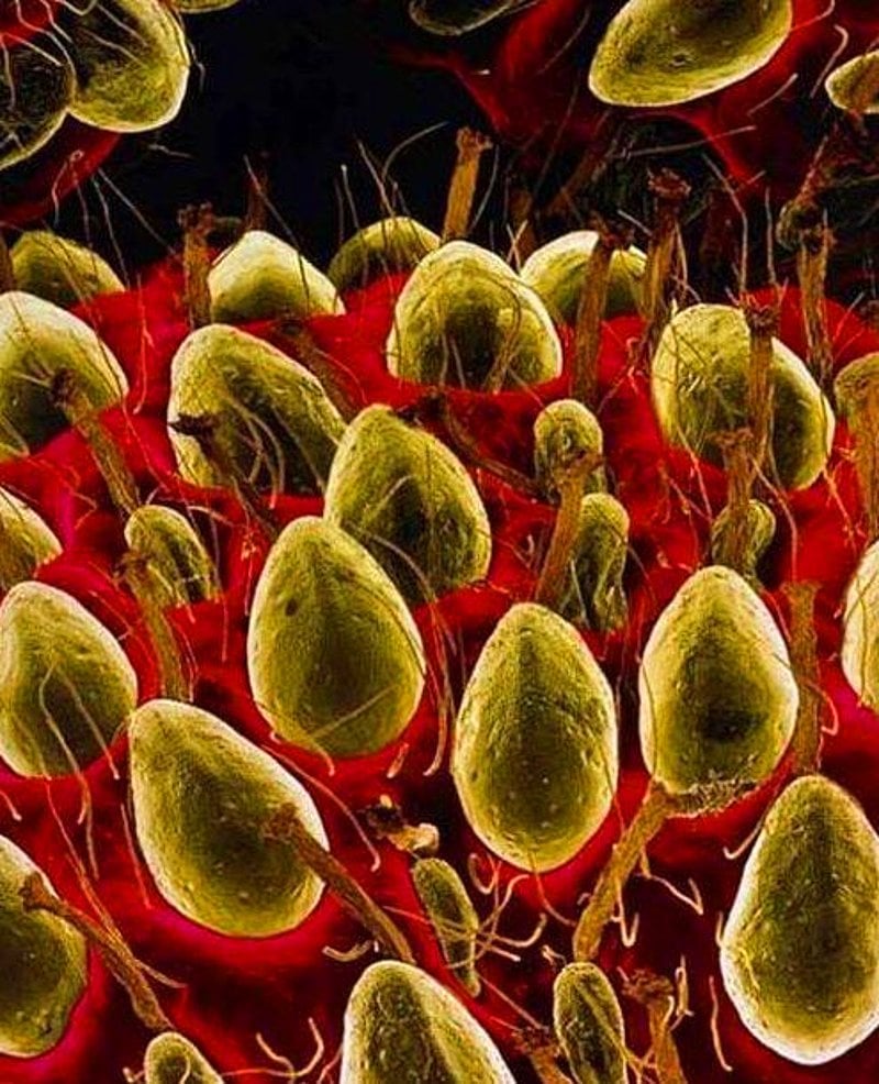 Fresas bajo el microscopio
