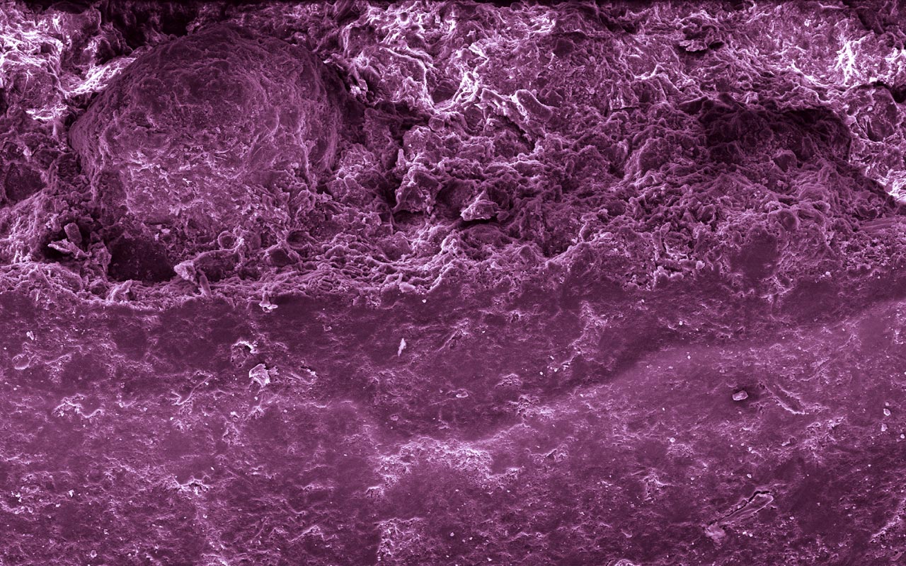 Vitamina C bajo el microscopio