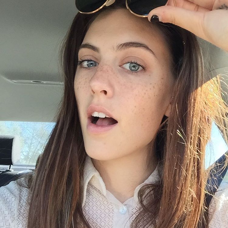 False_freckles_new_trend_06