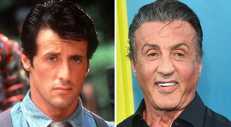 Sylvester Stallone | Personas famosas que han cambiado drásticamente a lo largo de los años | Bayas cerebrales