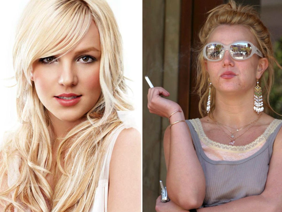 Top_10_dramatic_ceptity_transformations_for_better_or_worse_02