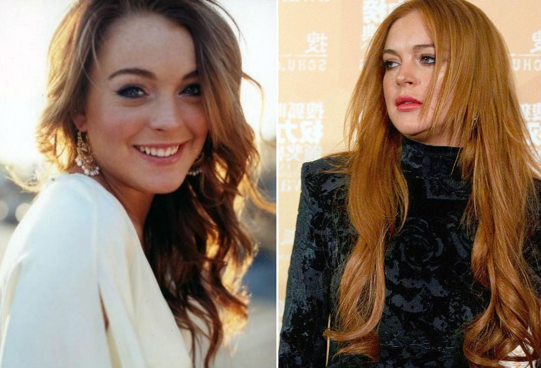 Top_10_dramatic_cepity_transformations_for_better_or_worse_06